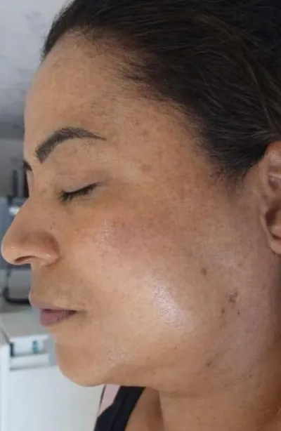 Depois de 45 dias