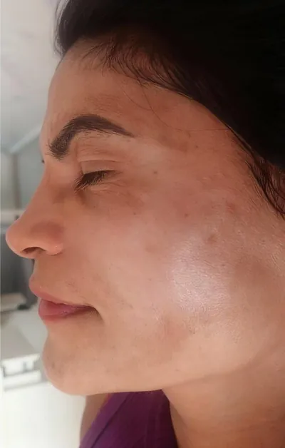 Depois de 2 meses